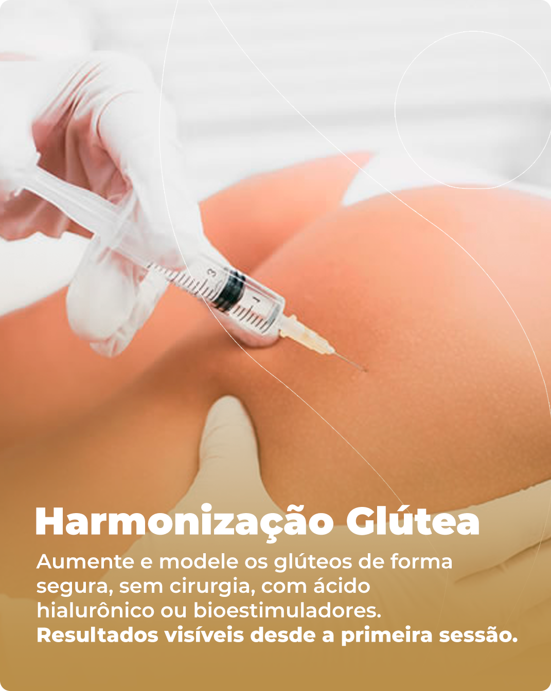 Harmonização Glútea