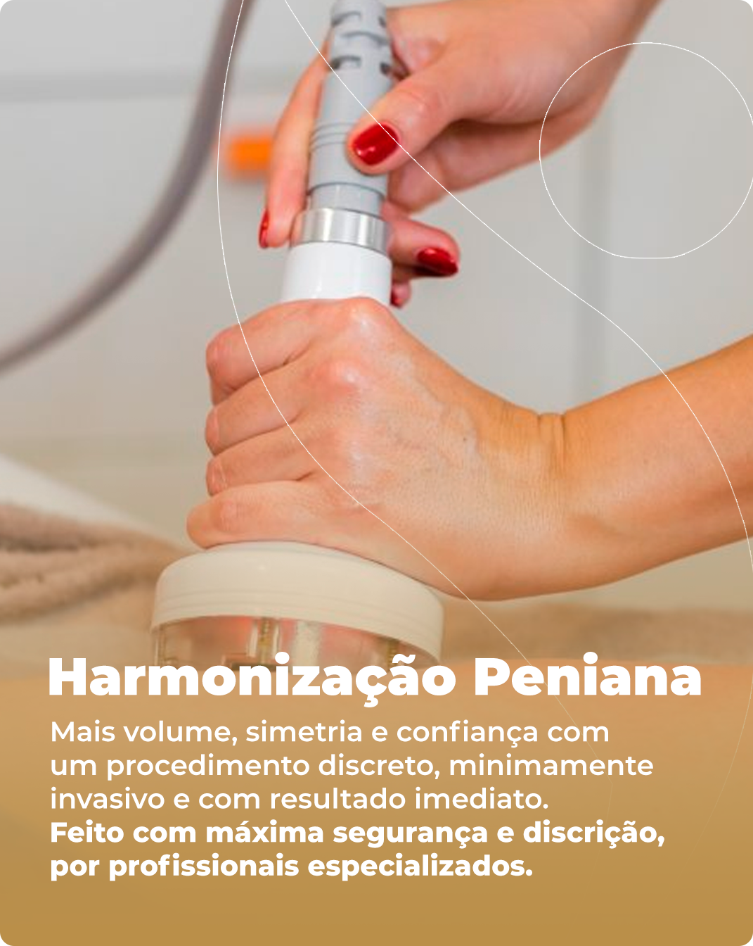 Harmonização Peniana