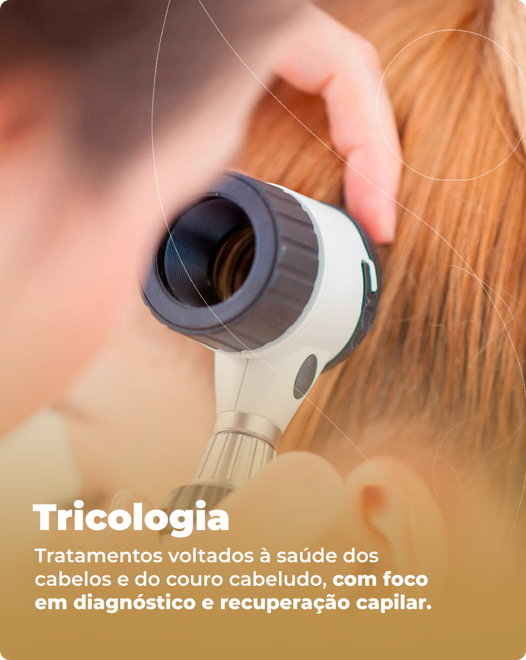 Tricologia